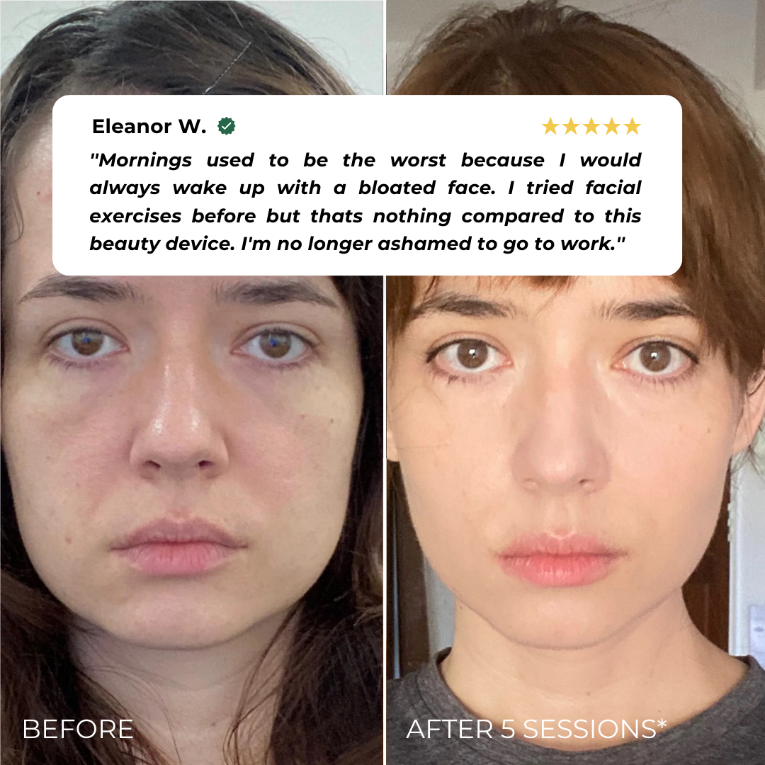 Elvia EMS Beauty Device