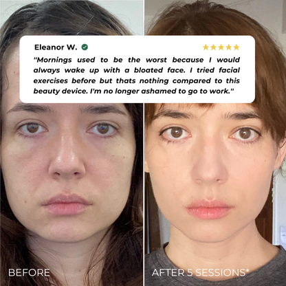 Elvia EMS Beauty Device