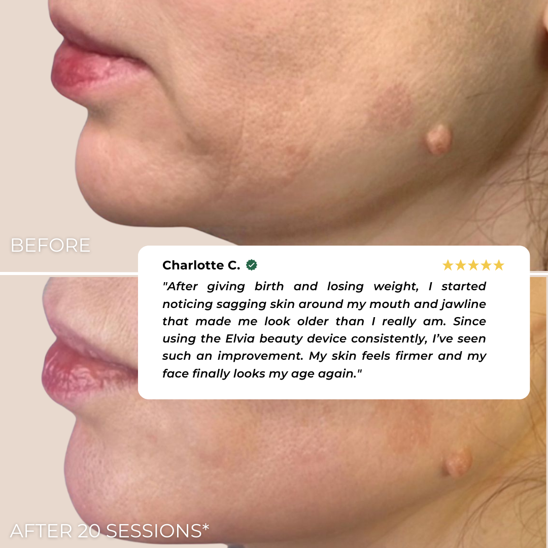 Elvia EMS Beauty Device