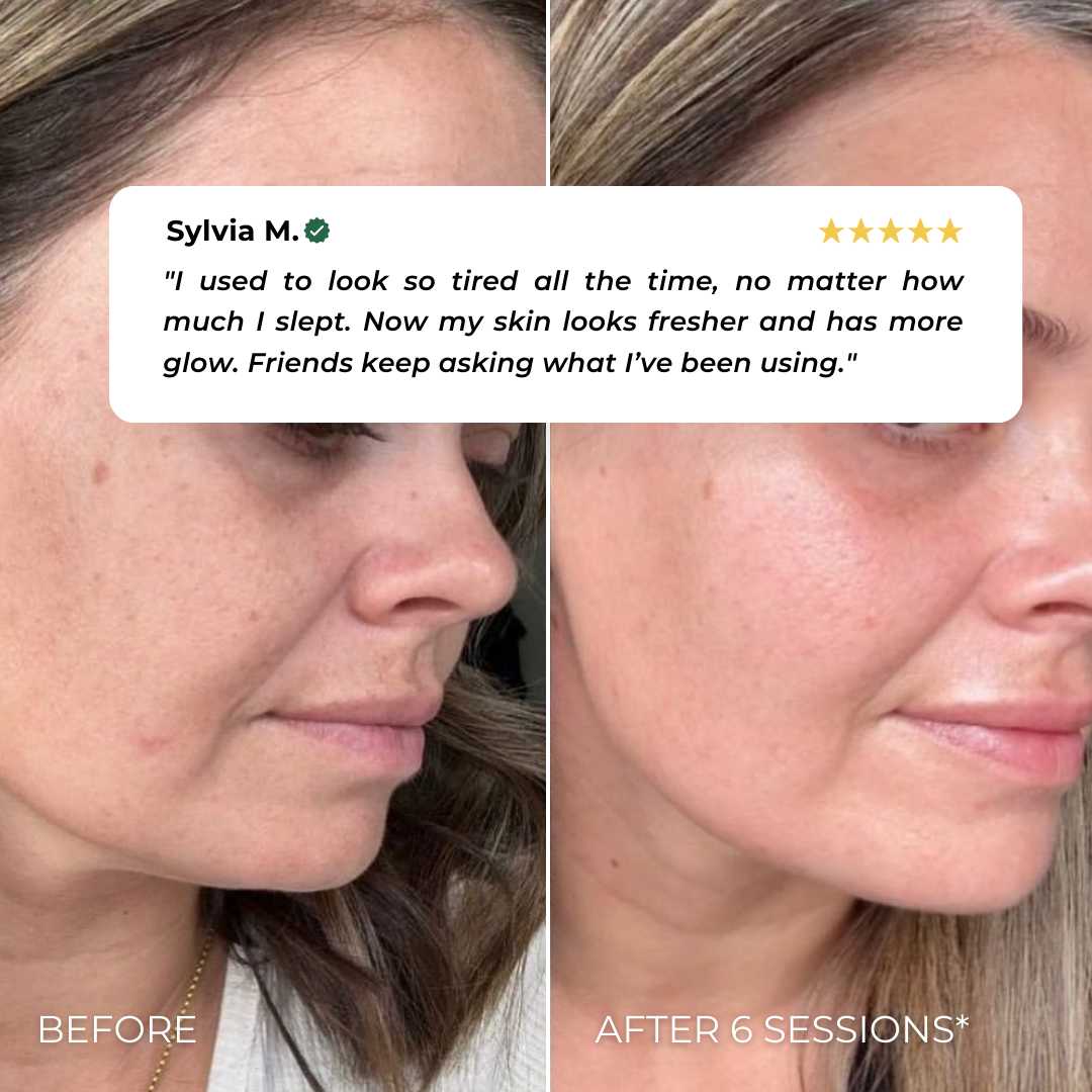 Elvia EMS Beauty Device